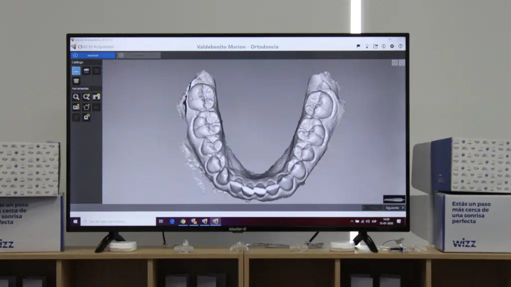 WIZZ 1 ,EntrepreNerd