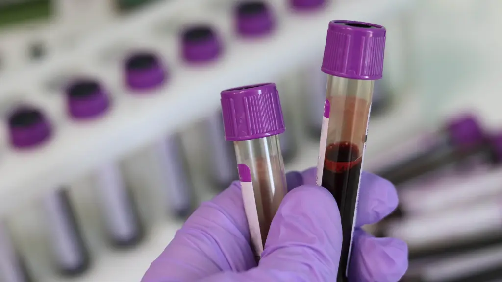 examen sangre ,EntrepreNerd