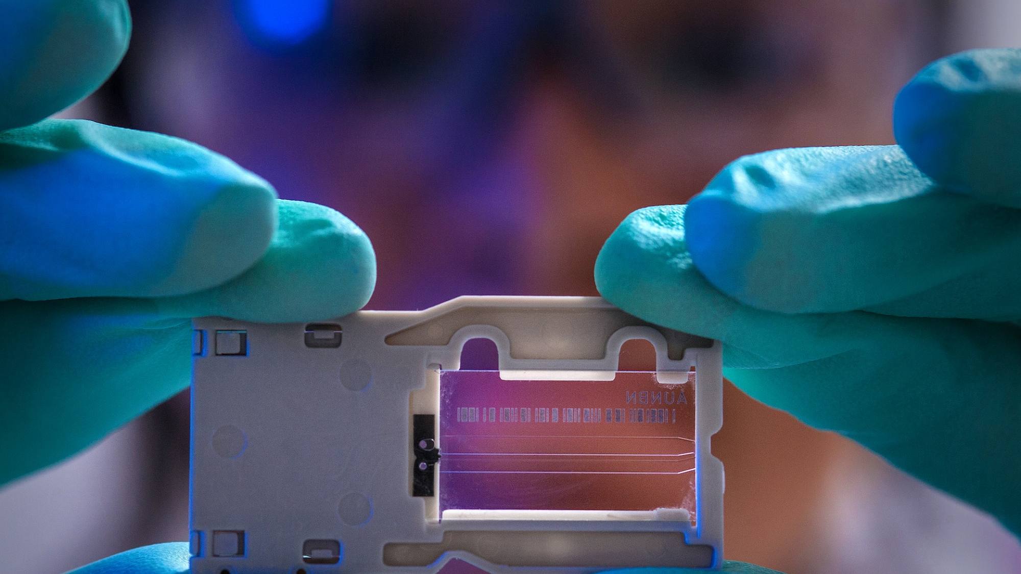 cdc UBJJuAOv9os , Unsplash